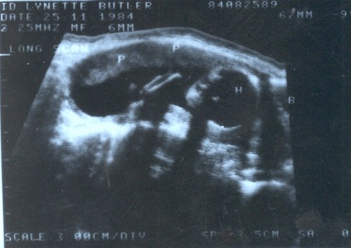Can you even tell this is a baby?  His head is on the right side of the image.